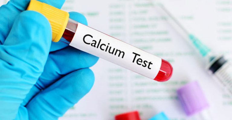 تست کلسیم-Calcium test