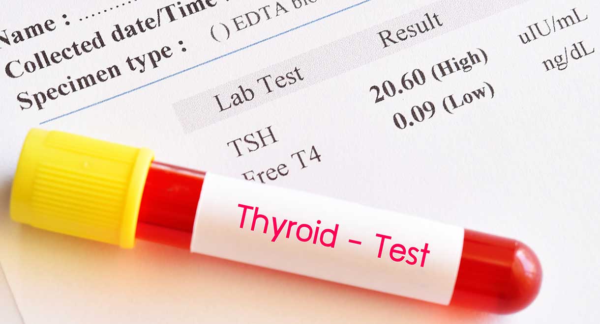 آزمایش های تیروئید-Thyroid-Test