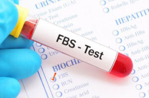 آزمایش قند خون ناشتا- FBS-TEST
