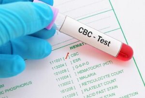 شمارش کامل سلول های خون / CBC Test