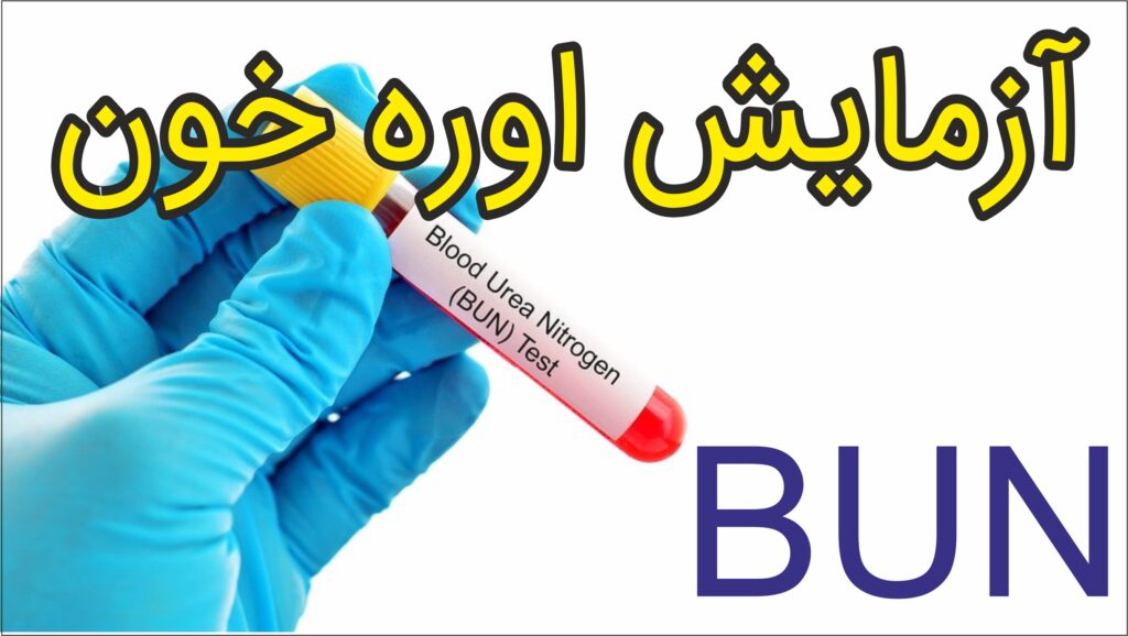 آزمايش اوره